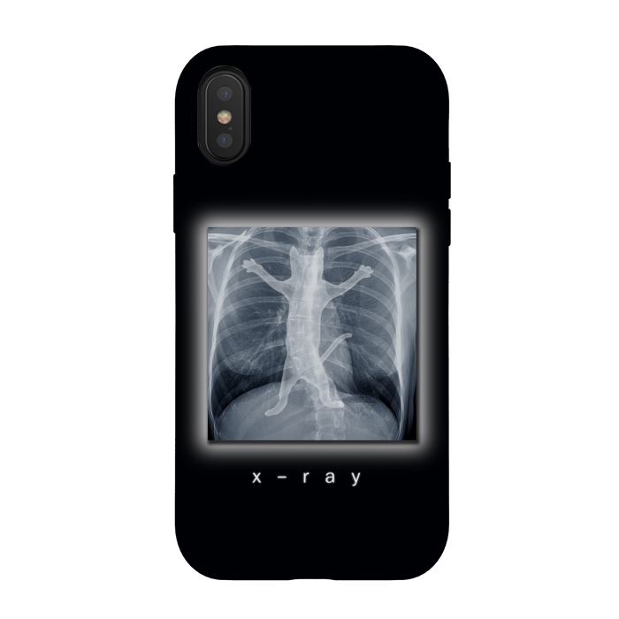 iPhone Xs / X StrongFit X-Ray by Tummeow