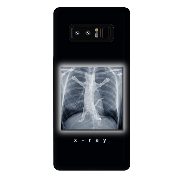 Galaxy Note 8 StrongFit X-Ray by Tummeow