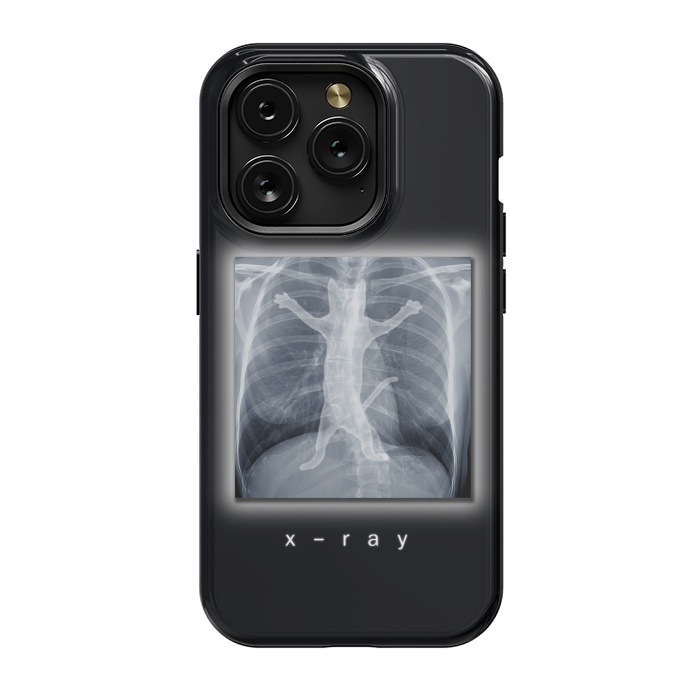 iPhone 15 Pro StrongFit X-Ray by Tummeow